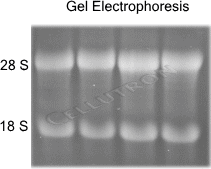 RNA gel electrophoresis